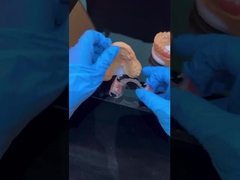 Quadro chiaro Acrilico Metallo Quadri di protesi parziali Alta estetica Laboratorio odontoiatrico cinese