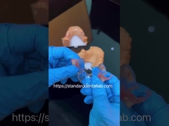 FDA Cobalto Cromo Estrema trasparenza estetica Parziale