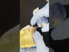 Cornice di colata in cromo di cobalto personalizzabile con adesivi molto buoni