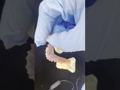 Protesi flessibili Valplast per il comfort naturale e la qualità estetica