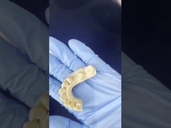 Corone di zirconia a contorno completo per un perfetto allineamento / comfort estetico