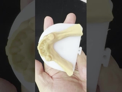 Metalli Leghe parziali Cobalt Protesi cromatiche Ivoclar Scheftner Confortevole Metallo Framewrok