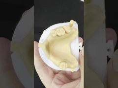 Metalli Leghe parziali Cobalt Protesi cromatiche Ivoclar Scheftner Confortevole Metallo Framewrok