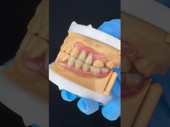 Modello di stampa 3D Alta estetica dentale TCS Valplast Flessibili protesi parziali Laboratorio dentale