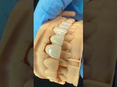 Corona di zirconia a contorno completo/Alta estetica naturale, ponte dentale di zirconia adidite personalizzato