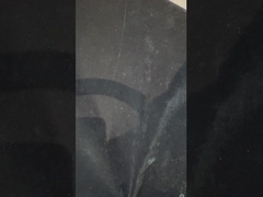 Protesi protesi di titanio con impianto protesi precise Ivoclar su impianti