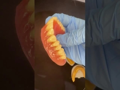 Denti parziali acrilici denti ivoclari gomma rosa