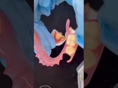 Modello di stampa 3D Alta estetica dentale TCS Valplast Flessibili protesi parziali Laboratorio dentale