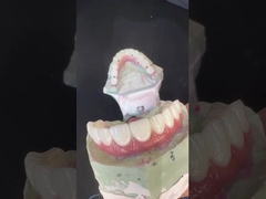 Denti chiari Ritenitore ortodontico Alta estetica Ritenitore Essix